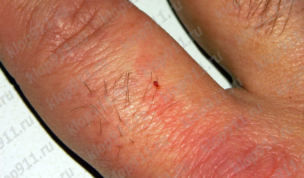 Larva bebendo sangue